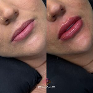 WhatsApp Image 2026-01-12 at 20.11.19 (1)