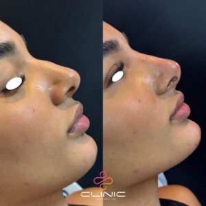 WhatsApp Image 2026-01-12 at 20.11.19