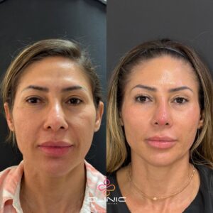 WhatsApp Image 2026-01-12 at 20.11.23