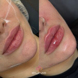 WhatsApp Image 2026-01-12 at 20.11.26 (3)