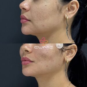 WhatsApp Image 2026-01-12 at 20.11.27 (3)