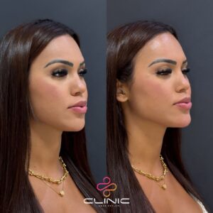 WhatsApp Image 2026-01-12 at 20.11.27