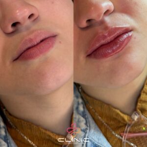 WhatsApp Image 2026-01-12 at 20.11.29