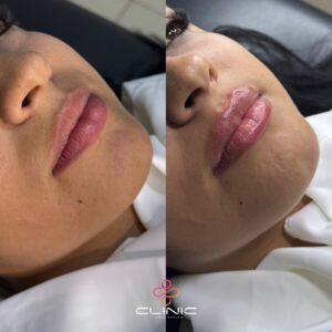 WhatsApp Image 2026-01-12 at 20.15.27